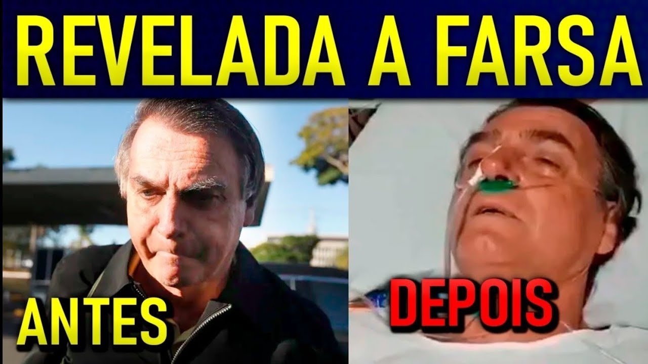 B0LSONARO TEM CRlSE DE PÂNlCO E CORRE PRO HOSPlTAL!! AVISADO DE PRlSÃO EM PLENO DOMINGO!!!
