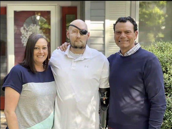 1º transplante de face e olho inteiro é bem-sucedido em norte-americano