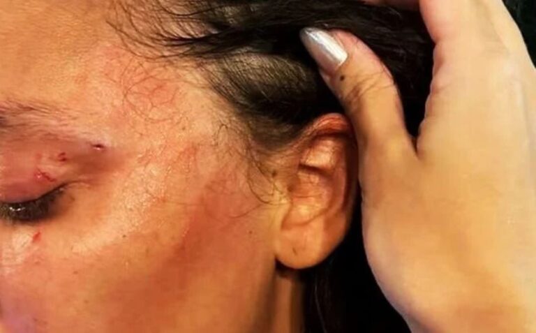 Mulher é agredida após usar banheiro feminino e ser confundida com trans em restaurante – Sociedade – CartaCapital