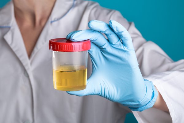 Por que o xixi é amarelo? Cientistas finalmente têm a resposta