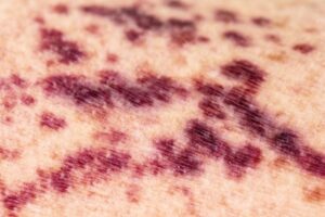 Você sabia que é possível observar problemas de saúde pela pele?