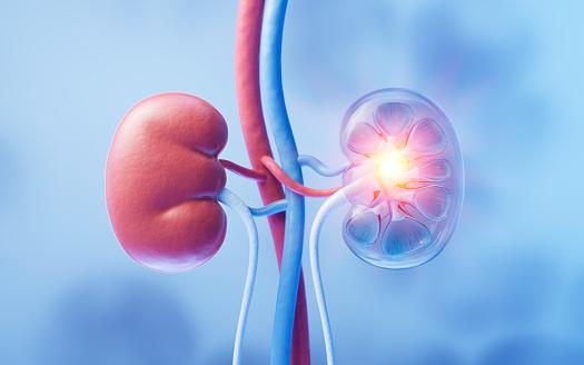 Milhões de pessoas sofrem com doença renal em todo o mundo. (Fonte: Getty Images/Reprodução)