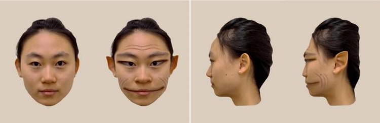 Prosopometamorfopsia: conheça o raro distúrbio que faz os pacientes enxergarem rostos 'demoníacos'