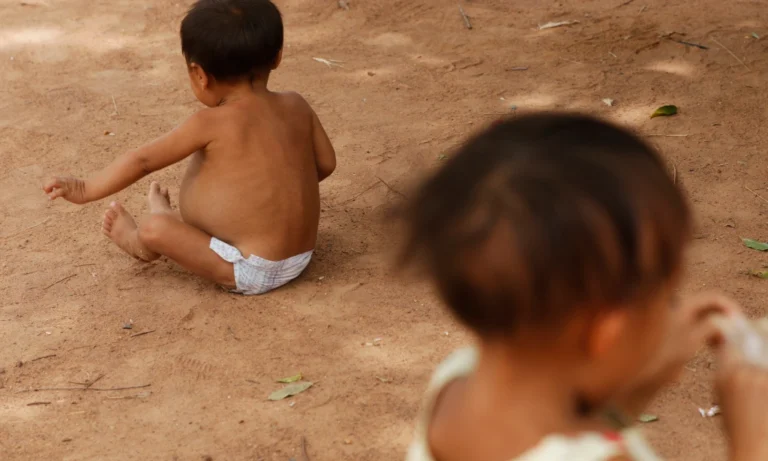Subnutrição severa em crianças Yanomami preocupa pesquisadores