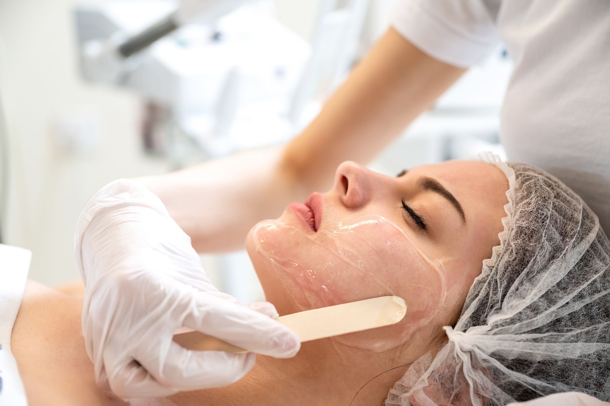 Peeling de fenol: o que é e quais são os riscos da técnica de rejuvenescimento?