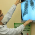 estudo indica tratamento preventivo mais curto