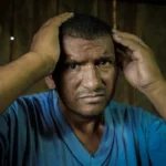 sobrevivente tem bala no olho há 30 anos