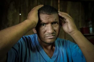 sobrevivente tem bala no olho há 30 anos