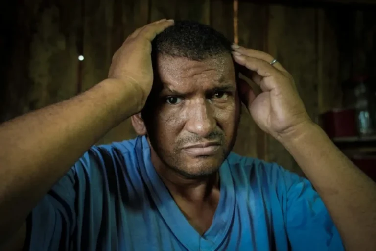 sobrevivente tem bala no olho há 30 anos