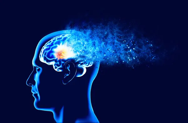 5 informações enganosas sobre o mal de Alzheimer